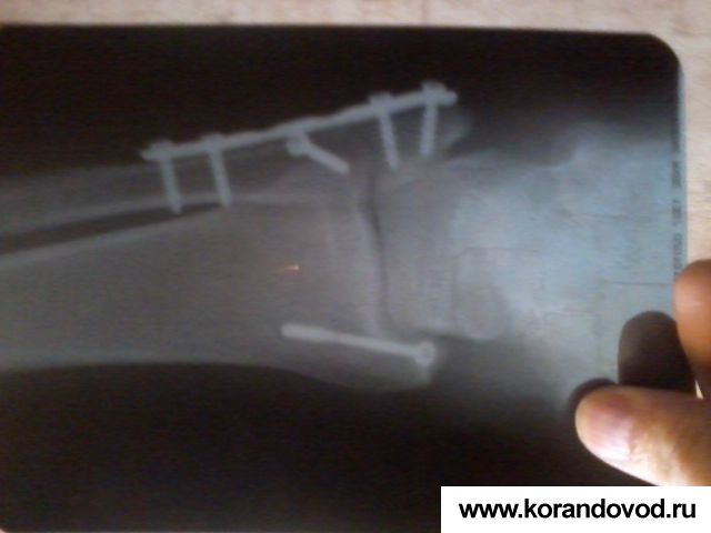 gallery_3954_210_4075.jpg